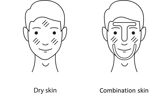 Dry skin Combination skin comparison